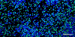 Apoptosis