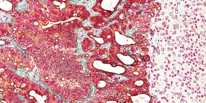 Immunhistochemie (IHC)