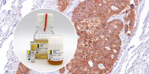 Histoprime blocking serum for IHC