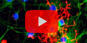 Qkine Webinar: Advanced neurobiology modeling with stem cells