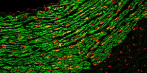 Epitope Tag Antibodies from Rockland Immunochemicals