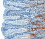 Atlas Antibodies standard immunohistochemistry (IHC) protocol